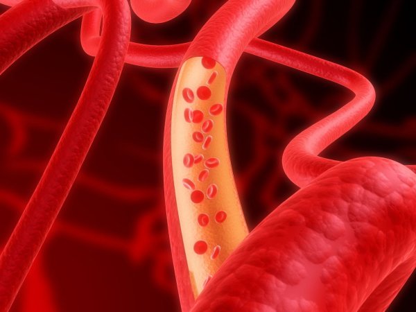 Ученые нашли способ минимизации повреждения кровеносных сосудов при диабете