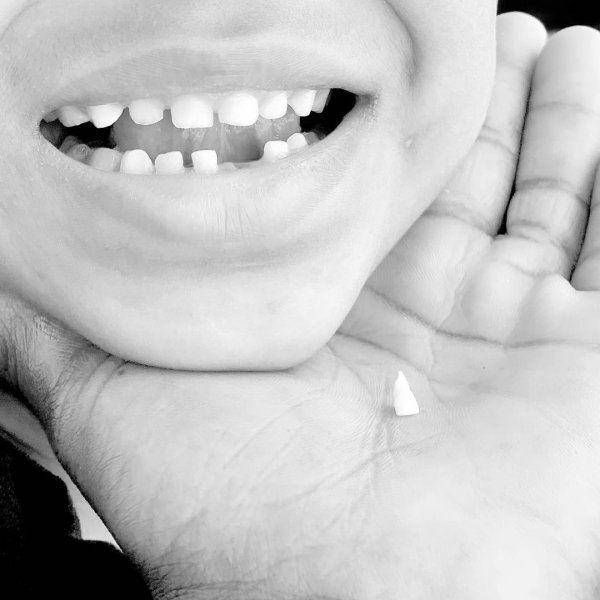 Не выбрасывайте мышкам и феям: Сохранение молочных зубов может исцелить ребенка от смертельных болезней
