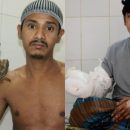 «Человек-дерево» попал в больницу Бангладеша из-за критического ухудшения состояния «Человек-дерево» попал в больницу Бангладеша из-за критического ухудшения состояния