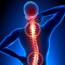 Учёные приблизились к безболезненному лечению сколиоза у взрослых Учёные приблизились к безболезненному лечению сколиоза у взрослых