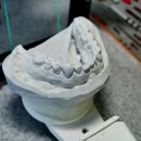 Костяной протез: Ученые научились создавать челюсть из ребра Костяной протез: Ученые научились создавать челюсть из ребра