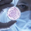 Кишечные бактерии способны останавливать рак – открытие Кишечные бактерии способны останавливать рак – открытие